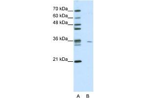 WB Suggested Anti-MDS032 Antibody Titration:  0.
