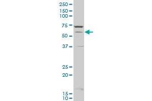 CYP1A2 polyclonal antibody (A01), Lot # 051122JC01 Western Blot analysis of CYP1A2 expression in A-431 .