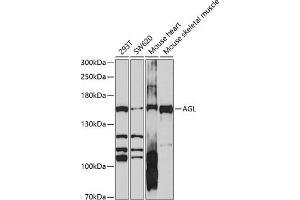 Western blot analysis of extracts of various cell lines, using AGL antibody (ABIN6131508, ABIN6136632, ABIN6136633 and ABIN6214165) at 1:1000 dilution.
