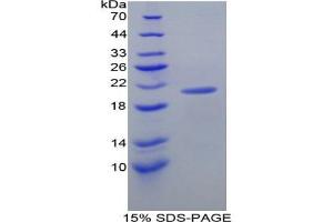 SDS-PAGE analysis of Mouse Diamine Oxidase Protein.