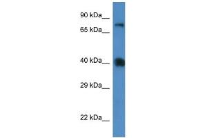 WB Suggested Anti-Slc7a3 Antibody   Titration: 1. (SLC7A3 anticorps  (Middle Region))