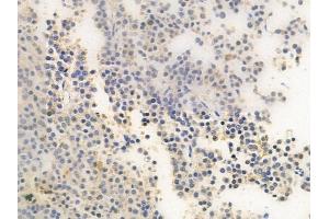 ABIN6259302 and ABIN6275409 at 1/100 staining human pituitary adenoma by IHC-P. (PPP1R16A anticorps  (Internal Region))