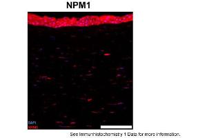 Sample Type: human cornea (frozen)Blue: DAPIRed: NPM1Primary Dilution: 1:100Image Submitted By: Geraint ParfittGavin Herbert Eye Institute . (NPM1 anticorps  (C-Term))