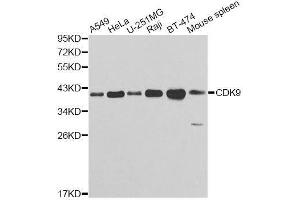 Western blot analysis of extracts of various cell lines, using CDK9 antibody.