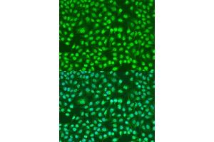 Immunofluorescence analysis of U2OS cells using PSEN2 antibody. (Presenilin 2 anticorps)