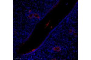 Immunofluorescence of paraffin embedded rat uterus using LIF (ABIN7074457) at dilution of 1: 700 (200x lens)