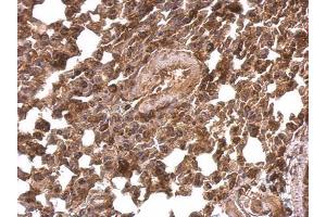 IHC-P Image BACE1 antibody [N1C2] detects BACE1 protein at cytosol and membrane on mouse lung by immunohistochemical analysis. (BACE1 anticorps)
