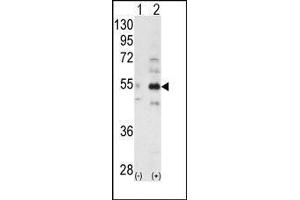 Western blot analysis of ALS2CR2 (arrow) using ALS2CR2 Antibody
