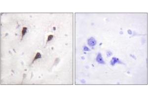 Immunohistochemistry analysis of paraffin-embedded human brain tissue, using WAVE1 (Ab-125) Antibody.