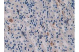 Used in DAB staining on fromalin fixed paraffin- embedded brain tissue (Aggrecan anticorps  (AA 587-684))