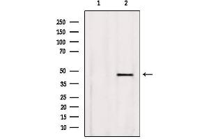 Western blot analysis of extracts from Rat heart, using BBS5 Antibody. (BBS5 anticorps  (C-Term))