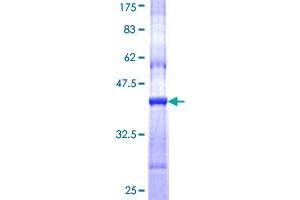 Image no. 1 for Cholinergic Receptor, Nicotinic, delta (Muscle) (CHRND) (AA 24-130) protein (GST tag) (ABIN1349419)