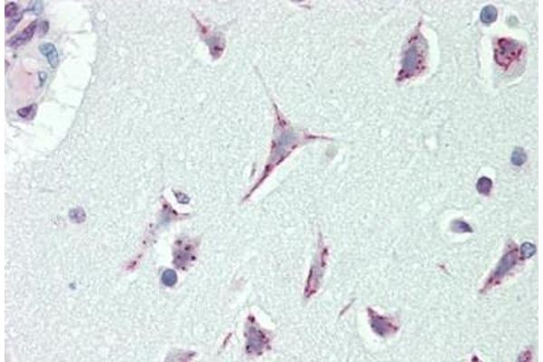CASC4 anticorps  (AA 336-365)