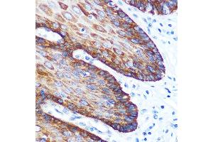 Immunohistochemistry of paraffin-embedded human esophageal using GM130 Rabbit mAb (ABIN7267494) at dilution of 1:100 (40x lens). (Golgin A2 (GOLGA2) anticorps)