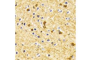 Immunohistochemistry of paraffin-embedded Rat brain using BIN1 antibody at dilution of 1:100 (x400 lens).