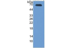 WB of Protein Standard: different control antibodies  against Highly purified E.