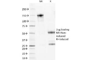 SDS-PAGE Analysis Purified Wilm's Tumor Mouse Monoclonal Antibody (6F-H2). (WT1 anticorps  (AA 1-181))