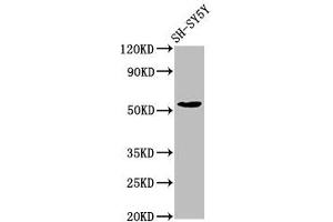 Western Blot Positive WB detected in: SH-SY5Y whole cell lysate All lanes: MZF1 antibody at 7. (MZF1 anticorps  (AA 186-354))