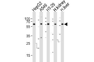 Western blot analysis of lysates from HepG2, A549, HT-29 cell line, human kidney and liver tissue lysate (from left to right), using CYP3A4 Antibody at 1:1000 at each lane.