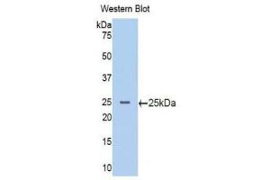 Western Blotting (WB) image for anti-Phosphoinositide-3-Kinase, Catalytic, beta Polypeptide (PIK3CB) (AA 524-703) antibody (ABIN1176787) (PIK3CB anticorps  (AA 524-703))