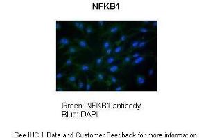 Sample Type :  Chicken DF-1 Firboblast  Primary Antibody Dilution :  1:100  Secondary Antibody :  Anti-rabbit FITC  Secondary Antibody Dilution :  1:300  Color/Signal Descriptions :  NFKB1: Green DAPI:Blue  Gene Name :  NFKB1   Submitted by :  Anonymous