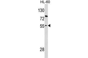 Western blot analysis of PAX8 Antibody (Center) in HL-60 cell line lysates (35ug/lane). (PAX8 anticorps  (Middle Region))