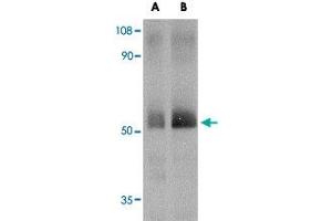Western blot analysis of SPRED2 in human small intestine tissue lysate with SPRED2 polyclonal antibody  at (A) 1 and (B) 2 ug/mL . (SPRED2 anticorps  (Internal Region))