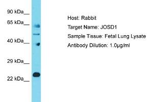 Host: Rabbit Target Name: JOSD1 Sample Tissue: Human Fetal Lung Antibody Dilution: 1ug/ml (JOSD1 anticorps  (N-Term))