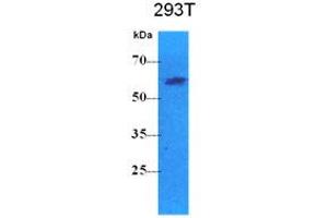 Western Blotting (WB) image for anti-Pyruvate Kinase, Liver and RBC (PKLR) antibody (ABIN781545) (PKLR anticorps)