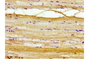 Immunohistochemistry of paraffin-embedded human skeletal muscle tissue using ABIN7142919 at dilution of 1:100 (AKIP1 anticorps  (AA 57-167))