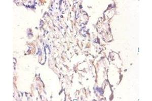 Immunohistochemistry of paraffin-embedded human placenta tissue using ABIN7145696 at dilution of 1:100 (BMP6 anticorps  (AA 382-513))