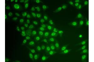 Immunofluorescence analysis of HeLa cells using CRY2 antibody (ABIN6130206, ABIN6139068, ABIN6139070 and ABIN6217229).