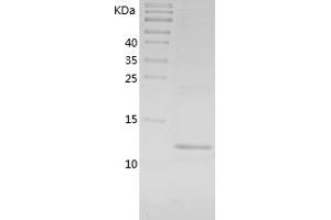 Western Blotting (WB) image for Chemokine (C-C Motif) Ligand 7 (CCL7) (AA 24-97) protein (His tag) (ABIN7122312) (CCL7 Protein (AA 24-97) (His tag))