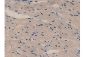 Detection of OCM in Mouse Heart Tissue using Polyclonal Antibody to Oncomodulin (OCM)