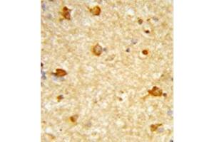 Formalin-fixed and paraffin-embedded human brain tissue reacted with DIRAS1 Antibody , which was peroxidase-conjugated to the secondary antibody, followed by DAB staining.