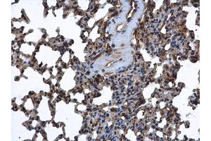 IHC-P Image FARSLA antibody [N2C2], Internal detects FARSLA protein at cytoplasm in mouse lung by immunohistochemical analysis.