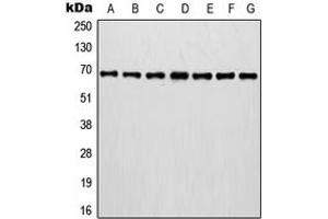 Western blot analysis of Involucrin expression in MCF7 (A), A375 (B), A431 (C), NIH3T3 (D), HT1080 (E), mouse brain (F), rat brain (G) whole cell lysates. (Involucrin anticorps  (C-Term))