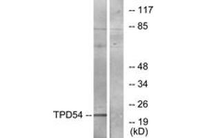Western Blotting (WB) image for anti-Tumor Protein D52-Like 2 (TPD52L2) (AA 141-190) antibody (ABIN2889321) (TPD52L2 anticorps  (AA 141-190))