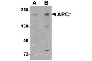 Western blot analysis of APC1 in SK-N-SH cell lysate with AP30057PU-N APC1 antibody at (A) 1 and (B) 2 μg/ml. (APC1 anticorps  (C-Term))