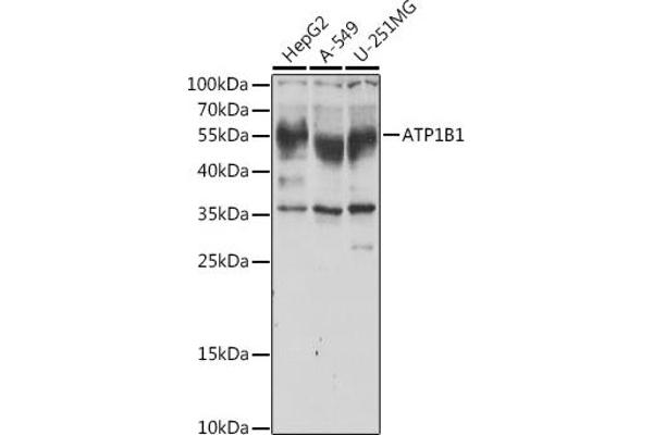 ATP1B1 anticorps  (AA 63-303)