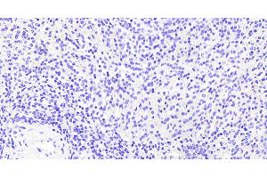 (ABIN185278) Negative Control showing staining of paraffin embedded Human Spleen, with no primary antibody.