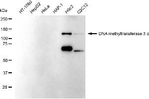 Western blotting analysis using DNA methyltransferase 3 alpha antibody (ABIN7798361).