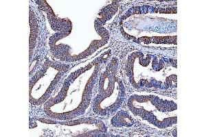 IHC analysis of Kindlin 2/FERMT2 using anti-Kindlin 2/FERMT2 antibody (ABIN7599515). (FERMT2 anticorps  (AA 1-650))
