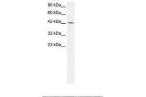 Image no. 2 for anti-Transcription Factor AP-4 (Activating Enhancer Binding Protein 4) (TFAP4) (AA 264-313) antibody (ABIN202277)