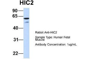 Host:  Rabbit  Target Name:  HIC2  Sample Type:  Human Fetal Muscle  Antibody Dilution:  1. (HIC2 anticorps  (Middle Region))