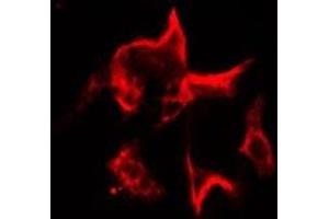 ABIN6277269 staining Hela cells by IF/ICC. (FLIP anticorps  (Internal Region))