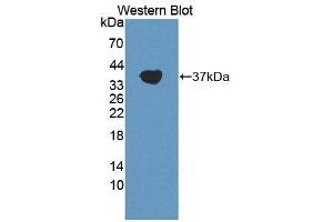 Detection of Recombinant C3a, Human using Polyclonal Antibody to Complement Component 3a (C3a) (C3a anticorps  (AA 672-748))