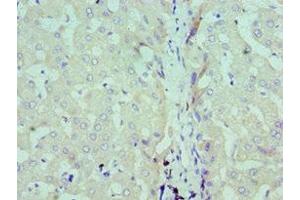 Immunohistochemistry of paraffin-embedded human liver tissue using ABIN7171193 at dilution of 1:100 (Syndecan 1 anticorps  (AA 25-240))