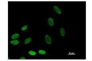 Immunostaining analysis in HeLa cells. (BAZ1B anticorps)
