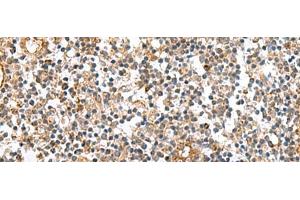 Immunohistochemistry of paraffin-embedded Human tonsil tissue using MRPS28 Polyclonal Antibody at dilution of 1:60(x200)